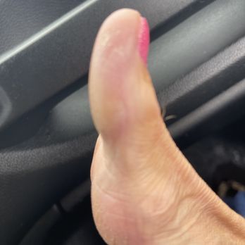 Platinum Nails - Callused toe - Nail Salons Near Me - Oak Hill, West Virginia Platinum Nails - Callused toe - Nail Salons Near Me - Oak Hill, West Virginia