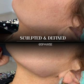 Spawise Medspa - Medical Spas Near Me - Dallas, Texas Spawise Medspa - Medical Spas Near Me - Dallas, Texas
