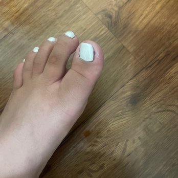 Bella Nails & Spa - Infected toe !! - Nail Salons Near Me - Ontario, California Bella Nails & Spa - Infected toe !! - Nail Salons Near Me - Ontario, California