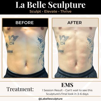 La Belle Sculpture - Medical Spas Near Me - Phoenix, Arizona