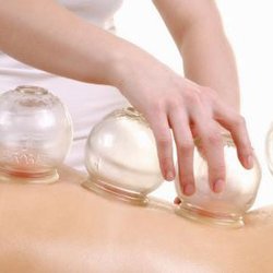 Lucy Wang Pain Relief Reflexology - DO AS THE PROS DO! FEEL THE ADVANTAGE OF CHINESE CUPPING