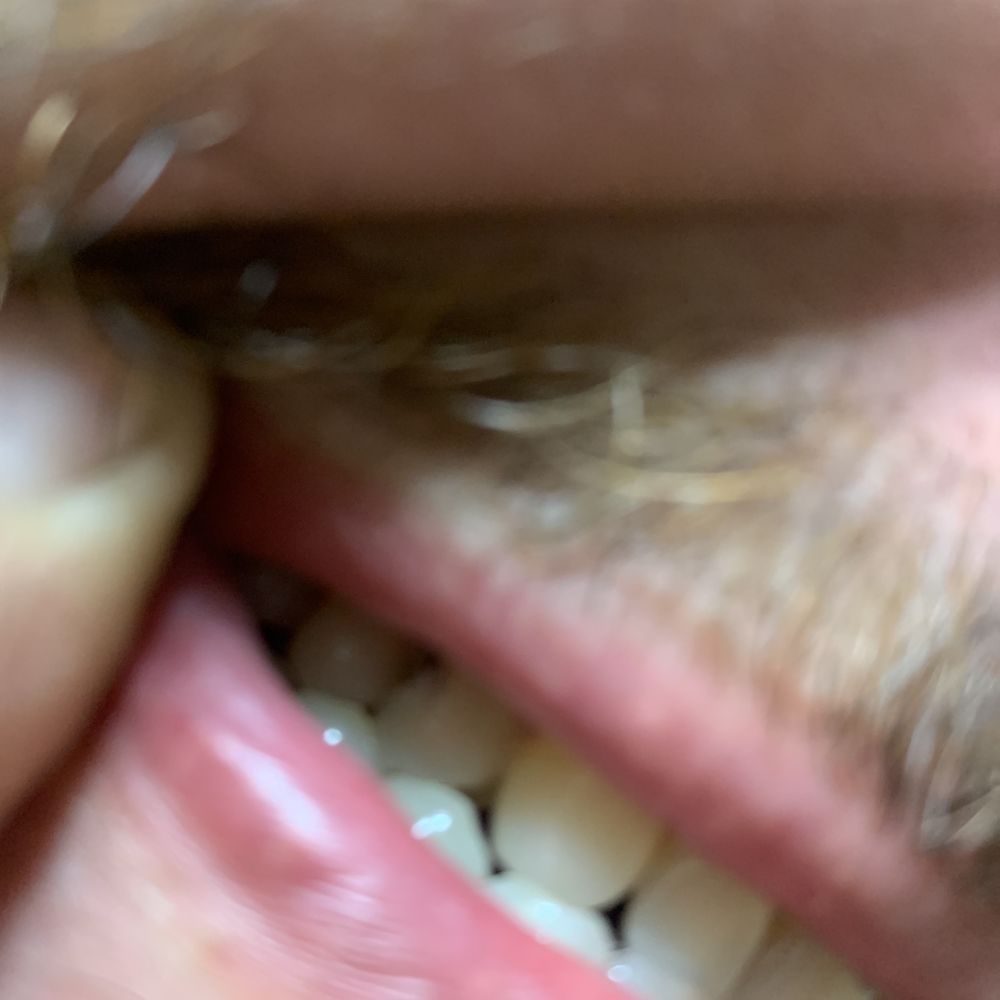 The tooth he cracked it did need a filling but wasn't cracked. He did what he wanted and not what I asked . It was a pissing contest