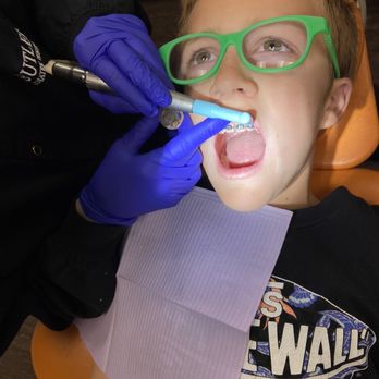 Butler Pediatric Dentistry - Routine cleaning, fluoride, & X-Rays today! - Pediatric Dentists Near Me - Fullerton, California Butler Pediatric Dentistry - Routine cleaning, fluoride, & X-Rays today! - Pediatric Dentists Near Me - Fullerton, California