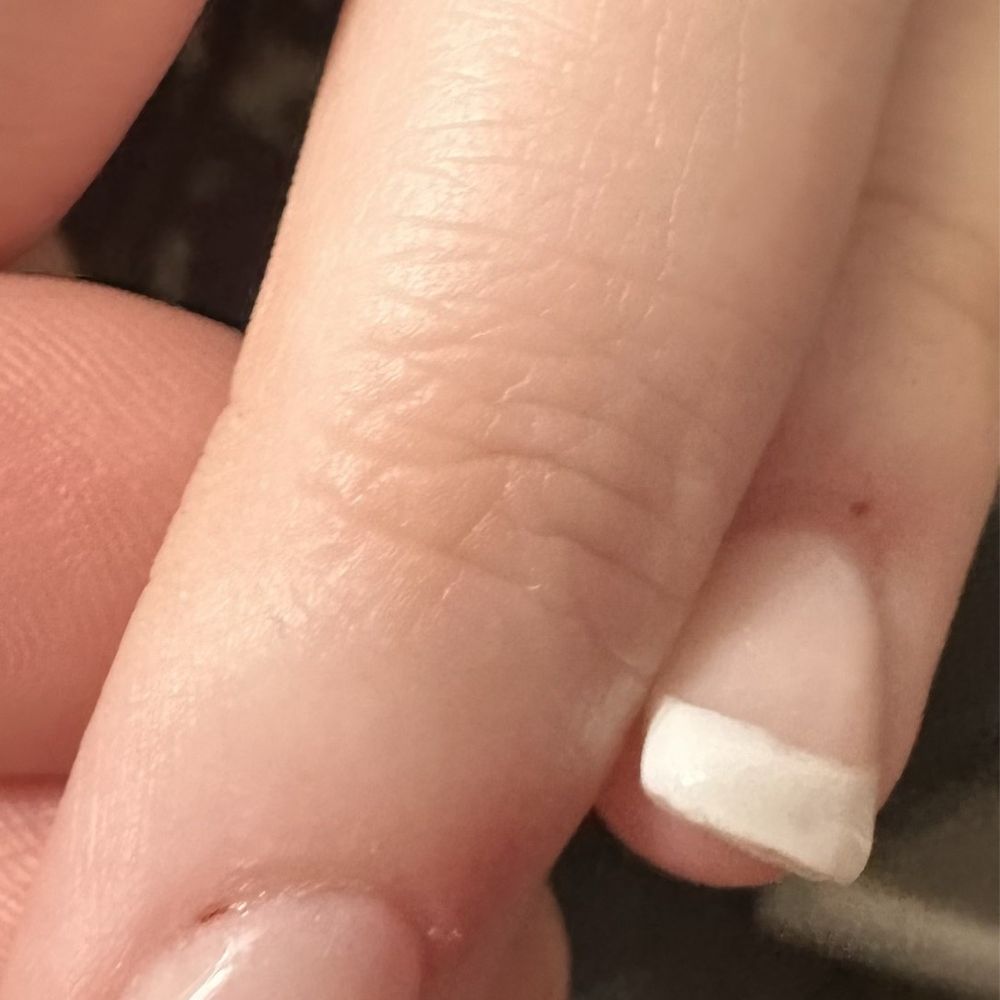 Rose Nails - Area of bleeding cuticle - Nail Salons Near Me - Phoenix, Oregon