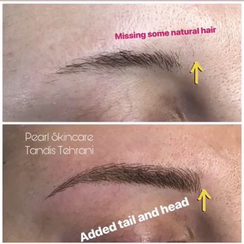 Pearl SkinCare - Before & After - Eyelash Service Near Me - San Diego, California Pearl SkinCare - Before & After - Eyelash Service Near Me - San Diego, California