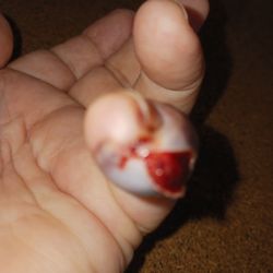 Patient First Primary & Urgent Care - Hampton - Three days after following recommended treatment.