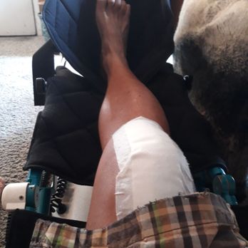 Raj Ahluwalia, MD - Knee replacement - Orthopedists Near Me - Los Angeles, California Raj Ahluwalia, MD - Knee replacement - Orthopedists Near Me - Los Angeles, California