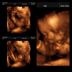 Baby View - The best pictures of my baby when he wasn't being camera shy.
