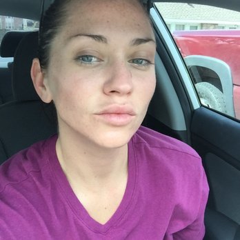 Bare Necessities - Upper Kirby - I suffer from acne and scares... After my facial, my skin looks soooo clean and fresh!!!!! - Skin Care Near Me - Houston, Texas Bare Necessities - Upper Kirby - I suffer from acne and scares... After my facial, my skin looks soooo clean and fresh!!!!! - Skin Care Near Me - Houston, Texas