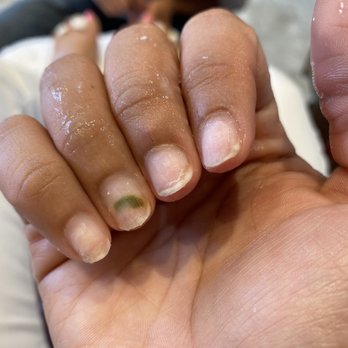 Elife Nail Spa - Fungus - Nail Salons Near Me - Charlotte, North Carolina Elife Nail Spa - Fungus - Nail Salons Near Me - Charlotte, North Carolina