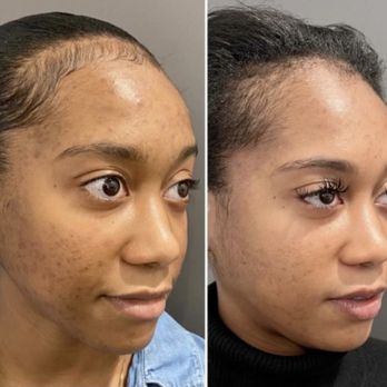 Regen RX Therapy - Medical Spas Near Me - Atlanta, Georgia