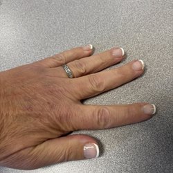Lucky Nails - Peeling fingernails