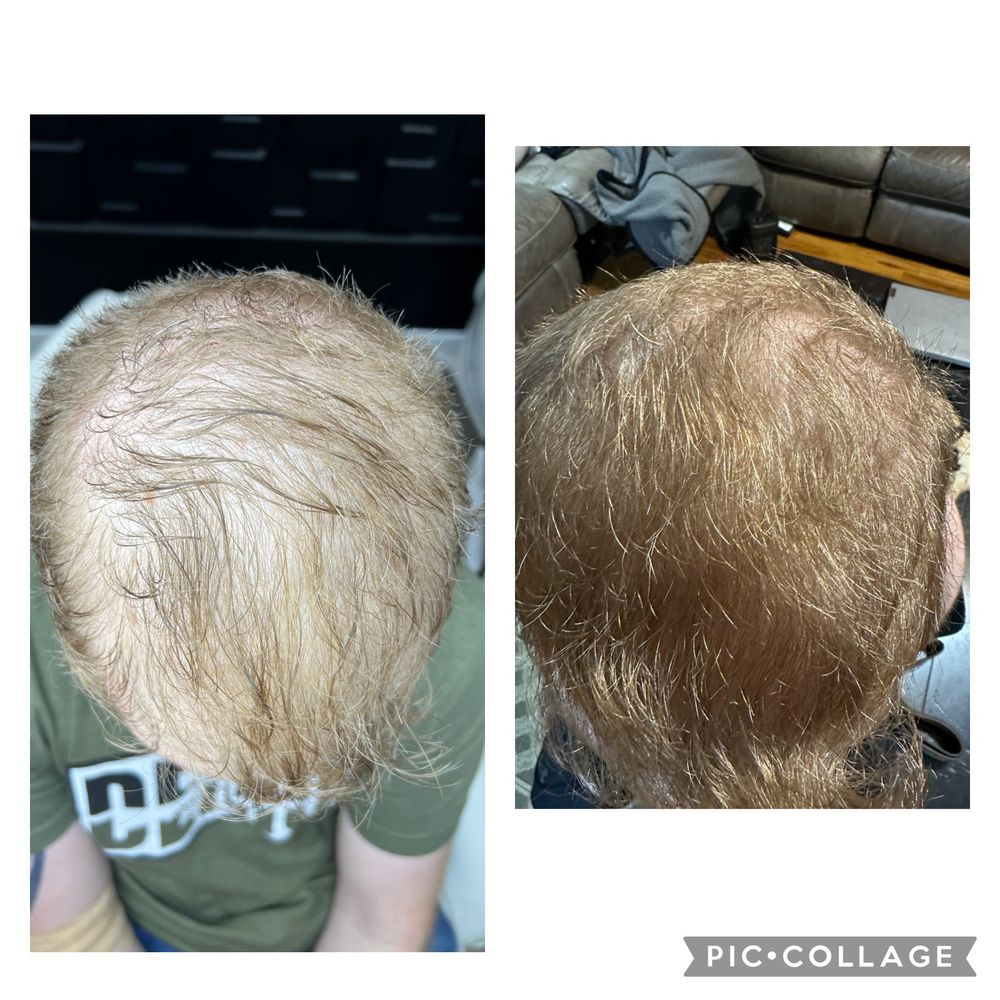 Hair Loss Solutions Logo