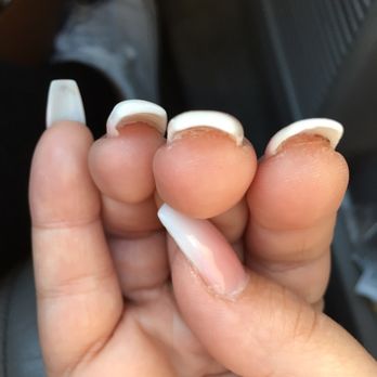 Solar Nails - Uneven thickness ring finger much fatter on one side - Nail Salons Near Me - Keizer, Oregon Solar Nails - Uneven thickness ring finger much fatter on one side - Nail Salons Near Me - Keizer, Oregon