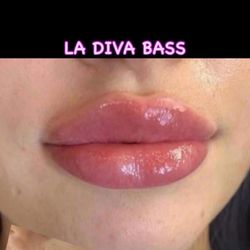 La Diva Beauty Angels - It's a before and after with HYA which is an abbreviation to Hyaluronic Acid