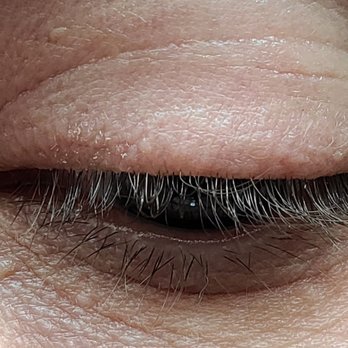Olivia & Lash - after 5 days I began to peel because the product burned me. Left eye. - Eyelash Service Near Me - Palo Alto, California Olivia & Lash - after 5 days I began to peel because the product burned me. Left eye. - Eyelash Service Near Me - Palo Alto, California