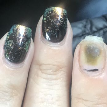 Polished Bar - After a week of a new manicure. Mold was forming due to old dip powder the nail tech didn't remove. - Nail Salons Near Me - Orange, California Polished Bar - After a week of a new manicure. Mold was forming due to old dip powder the nail tech didn't remove. - Nail Salons Near Me - Orange, California