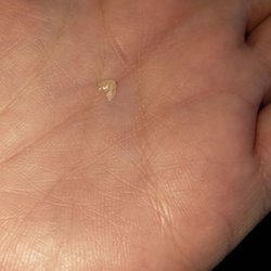 Quabbin Valley Dental - Piece of a filling done today. Just fell out while I was driving home afterwards. I had not eaten either.