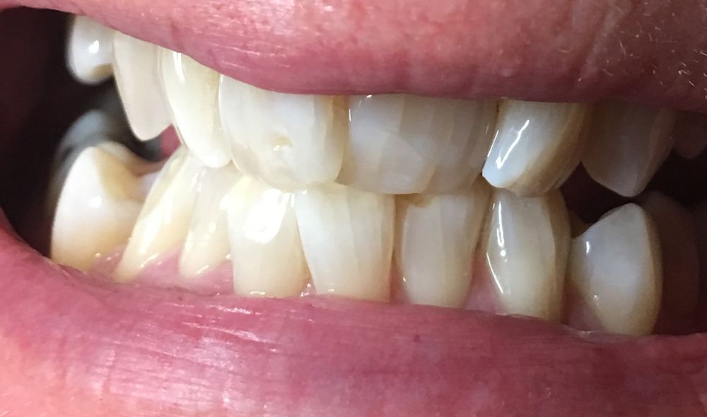 Adirondack Laser & Skin Esthetics Logo