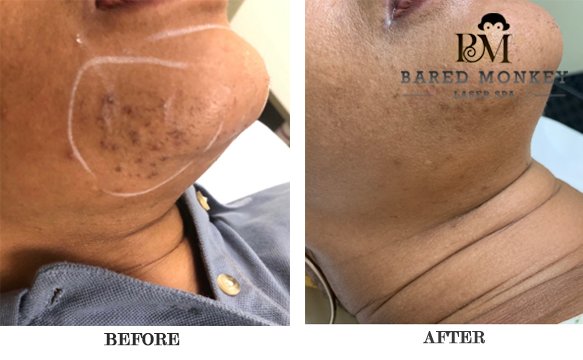 Bared Monkey Laser Spa by null