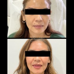 Touch Me Up Medical Spa & Skin Center