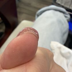 Poorly applied Gel X nails.