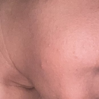 Massage Envy - More pimples on my chin - Massage Near Me - Dumfries, Virginia Massage Envy - More pimples on my chin - Massage Near Me - Dumfries, Virginia