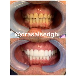 Asal Sedghi, DDS - Before/After
