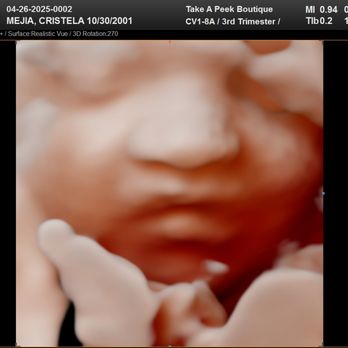 Take A Peek Boutique - Ultrasound Imaging Centers Near Me - Gilroy, California Take A Peek Boutique - Ultrasound Imaging Centers Near Me - Gilroy, California