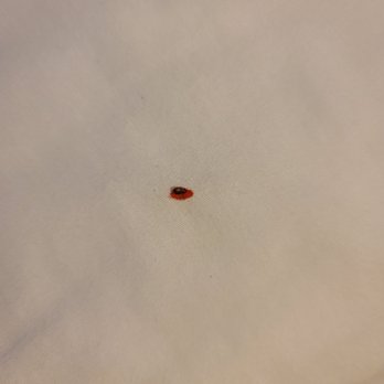 Motel 6 - Bed bug that bit me. - Hotels Near Me - Fort Bragg, California Motel 6 - Bed bug that bit me. - Hotels Near Me - Fort Bragg, California