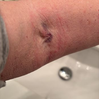 Labcorp - Bad experience at LabCorp on Chestnut St.. - Laboratory Testing Near Me - Philadelphia, Pennsylvania