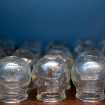 River Point Acupuncture - Cupping - Acupuncture Near Me - Omaha, Nebraska River Point Acupuncture - Cupping - Acupuncture Near Me - Omaha, Nebraska