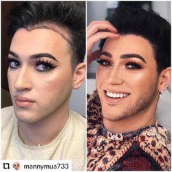 Ziering Medical - Manny Gutierrez sharing his lovely result