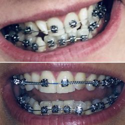 Smile Construction Orthodontics