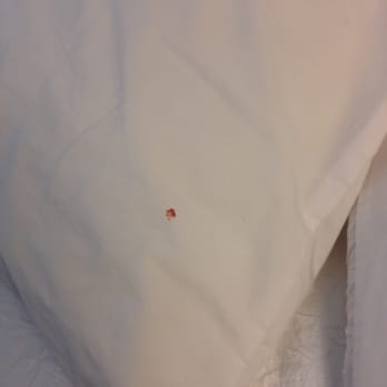 Hampton Inn Carrollton - Blood stain on a pillow case. - Hotels Near Me - Carrollton, Georgia