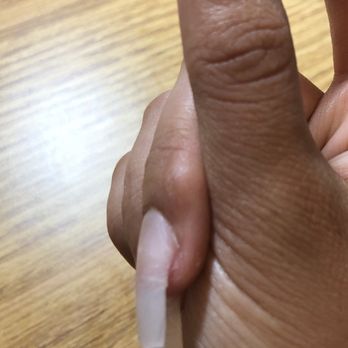 Ombre Nails - The same finger that was over filed - Nail Salons Near Me - Los Angeles, California