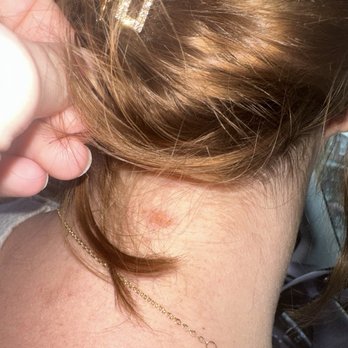 Salon Palomino - Chemical burn  , (I colored my hair after leaving salon ) - Hair Salons Near Me - Edgewater, Maryland