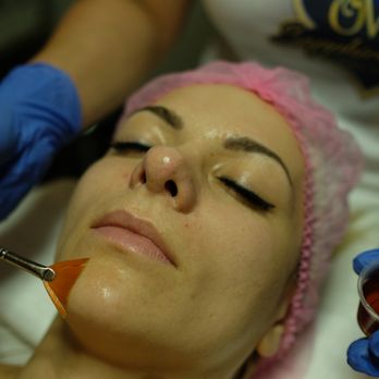Sapphire Elite Spa - Chemical Peel - Skin Care Near Me - East Brunswick, New Jersey Sapphire Elite Spa - Chemical Peel - Skin Care Near Me - East Brunswick, New Jersey