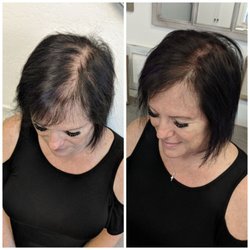 Britt Ink - Scalp micropigmentation ---- before and after