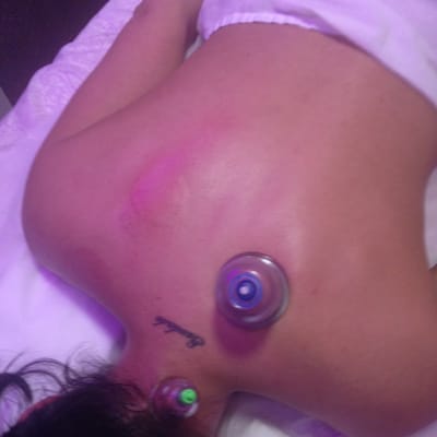 Acuwork Acupuncture & Massage by null