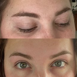 Before and After