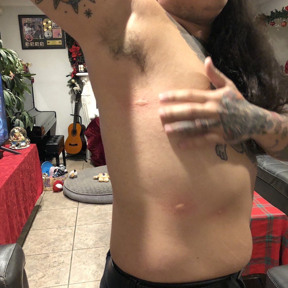 T's Nails & Spa - Mosquito bites all over the right side of my body! - Nail Salons Near Me - Stanton, California T's Nails & Spa - Mosquito bites all over the right side of my body! - Nail Salons Near Me - Stanton, California