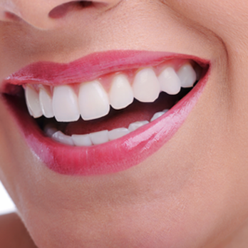 Nancy Derham, DDS - General Dentistry Near Me - Novato, California Nancy Derham, DDS - General Dentistry Near Me - Novato, California
