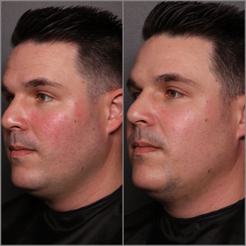 Eric Mariotti, MD - Cosmetic Surgeons Near Me - Concord, California