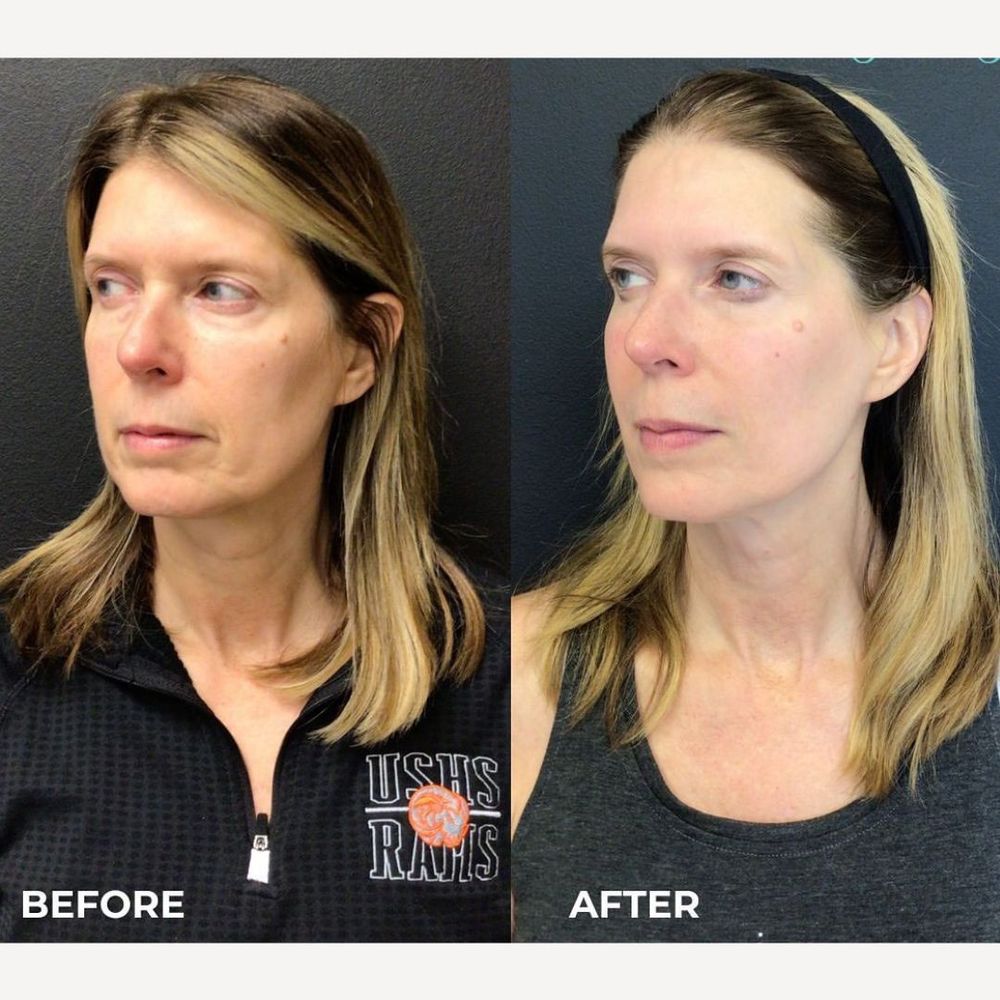 Juvly Aesthetics Logo