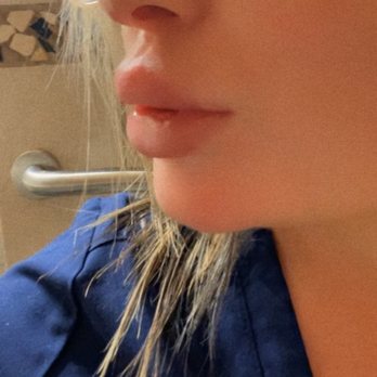 Alani Skin MD - Medical Spas Near Me - Scottsdale, Arizona Alani Skin MD - Medical Spas Near Me - Scottsdale, Arizona