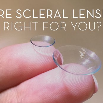 Orange County Eyecare Optometry - OC Eyecare Optometry specializing in fitting #scleral contacts for the purpose of treating #Keratoconus. Call us for a consultation - Optometrists Near Me - Placentia, California Orange County Eyecare Optometry - OC Eyecare Optometry specializing in fitting #scleral contacts for the purpose of treating #Keratoconus. Call us for a consultation - Optometrists Near Me - Placentia, California