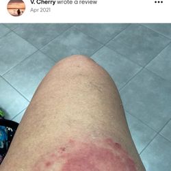 Golden Age Ranch - Here is the horse bite