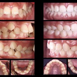 Little Mountain Dental Centre