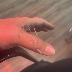 The Wellness Studio - Acupuncture